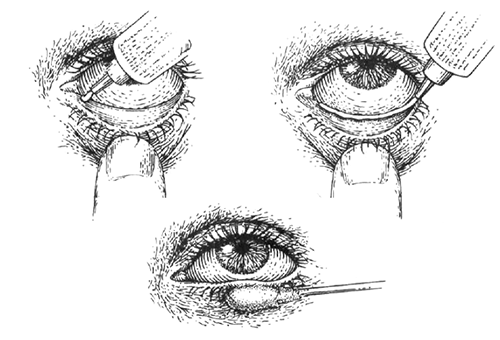 Глазные капли и мази : инструкция по применению